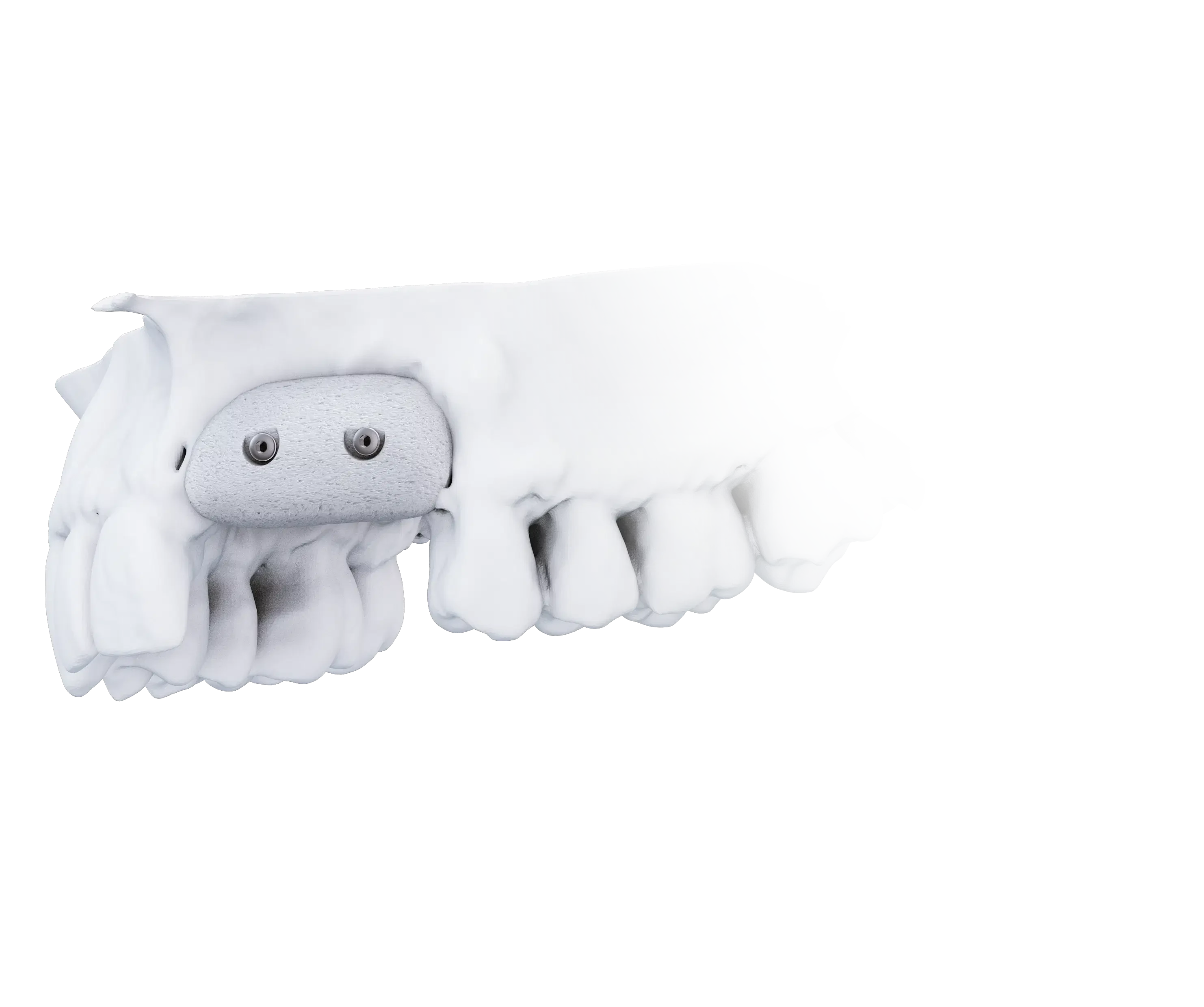Custom bone scaffold for a 3D-BONE reconstruction